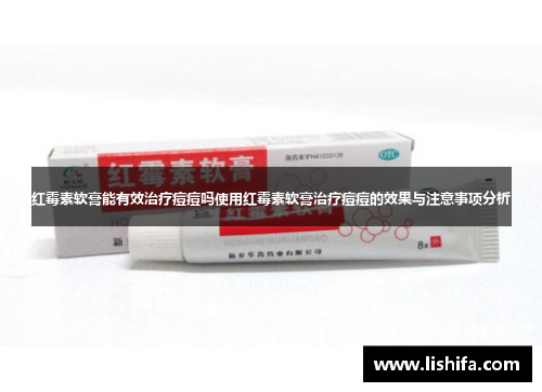 红霉素软膏能有效治疗痘痘吗使用红霉素软膏治疗痘痘的效果与注意事项分析